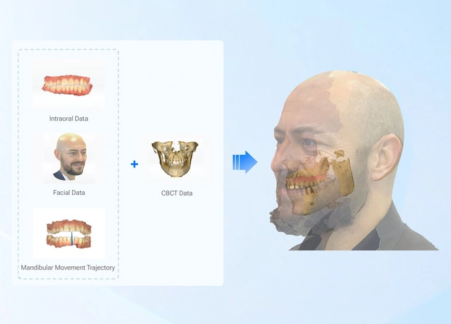 SHINING 3D Dental yüz ve ağız içi verilerini birleştiren sanal hasta görselleştirmesi