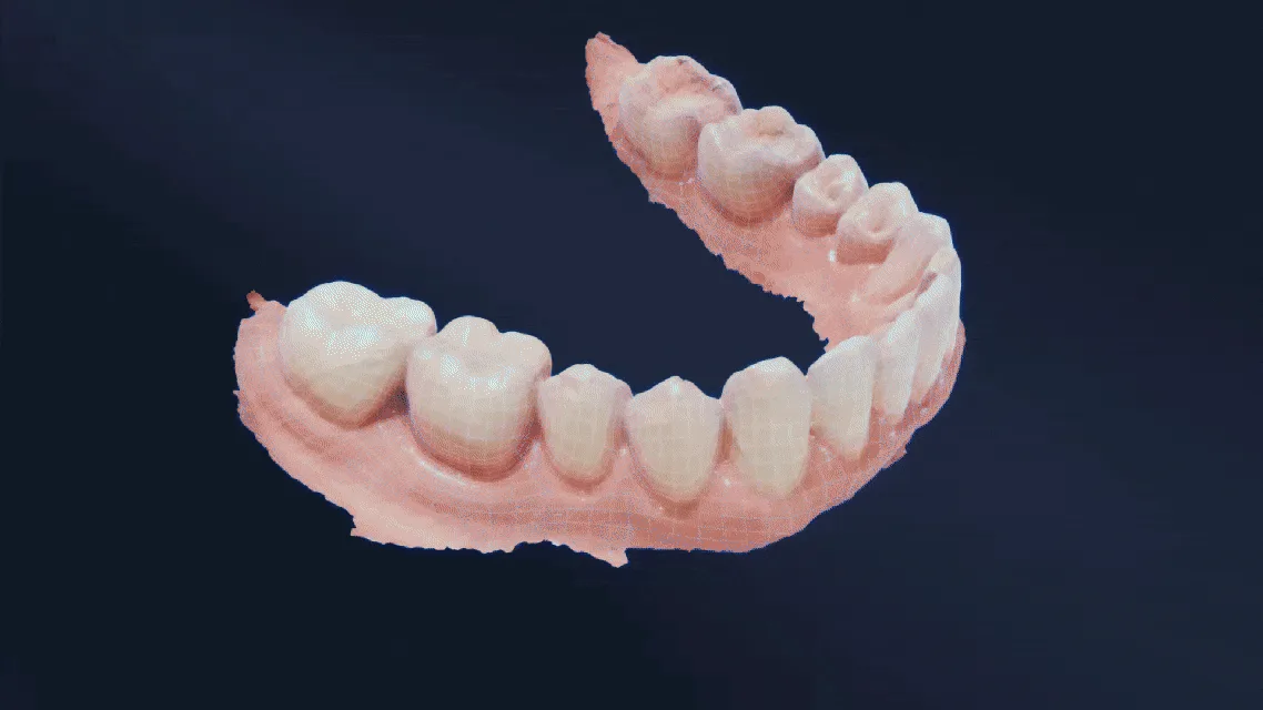 Shining 3D Dental Cloud — AI 3D Model