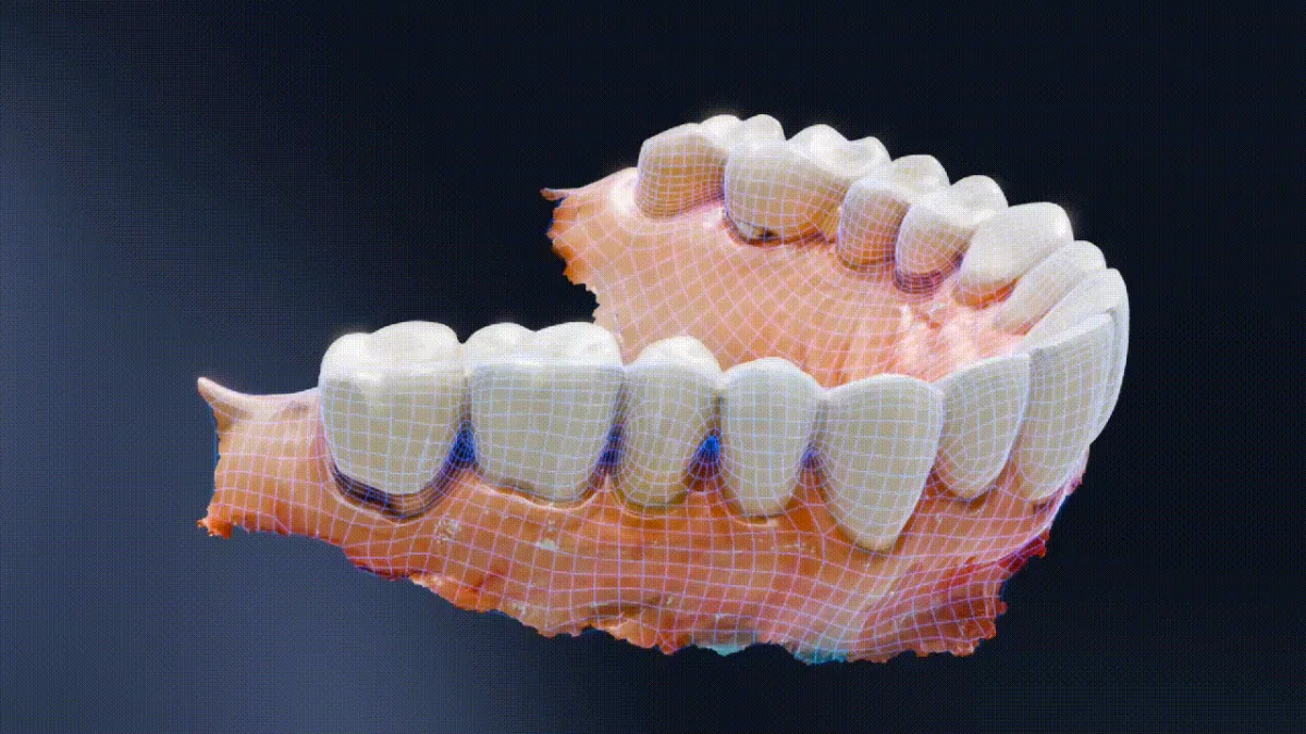 Shining 3D Dental Cloud — AI Retainer