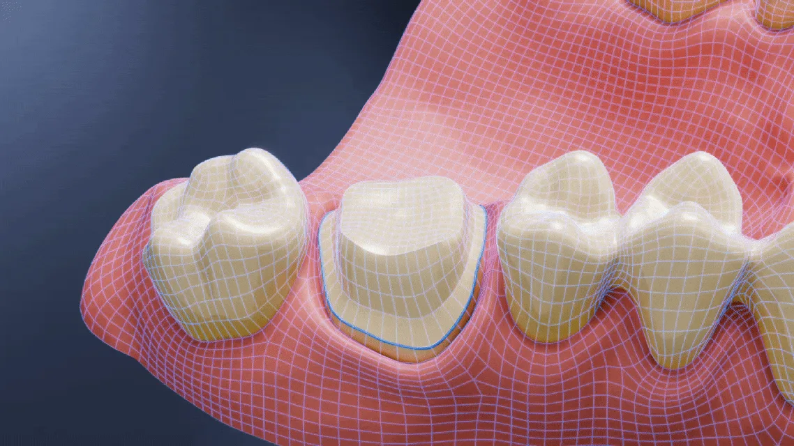 Shining 3D Dental Cloud — AI Kron