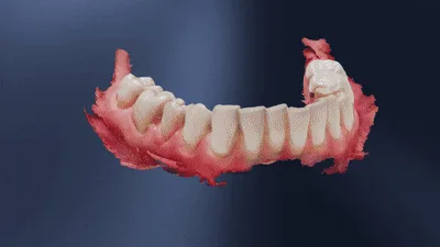 Shining 3D Dental Cloud — AI ABO Modeli
