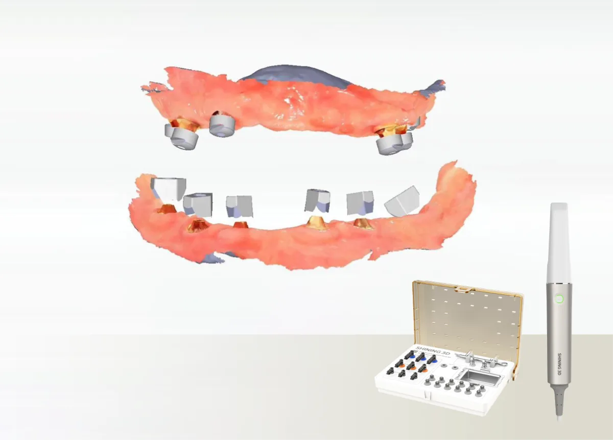 All-on-X için dental fotogrametri